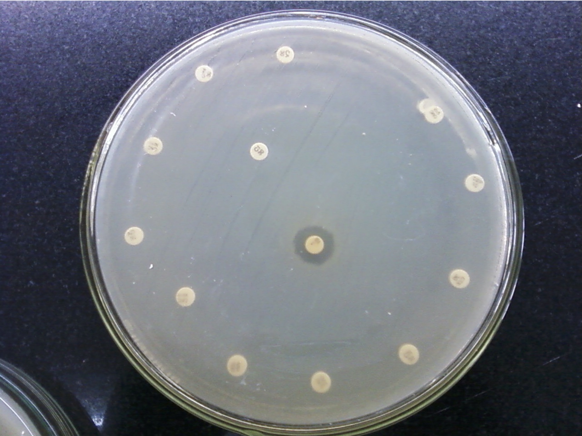 Antibiotic resistant bacteria2